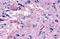 G Protein-Coupled Receptor 139 antibody, GTX70833, GeneTex, Immunohistochemistry paraffin image 