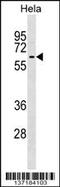 Kelch Like Family Member 12 antibody, 59-118, ProSci, Western Blot image 