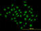 Histone Deacetylase 1 antibody, LS-B6094, Lifespan Biosciences, Immunofluorescence image 