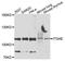 Integrin Subunit Alpha E antibody, A9934, ABclonal Technology, Western Blot image 