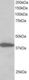 Protein Phosphatase 1 Regulatory Subunit 8 antibody, EB06037, Everest Biotech, Western Blot image 