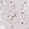 C-Type Lectin Domain Family 3 Member A antibody, HPA051511, Atlas Antibodies, Immunohistochemistry frozen image 
