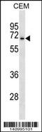 Acid Sensing Ion Channel Subunit 3 antibody, 60-330, ProSci, Western Blot image 