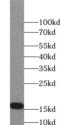 Natriuretic Peptide A antibody, FNab09839, FineTest, Western Blot image 