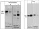 Kinase Insert Domain Receptor antibody, VP2871, ECM Biosciences, Immunocytochemistry image 