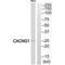 Calcium Voltage-Gated Channel Auxiliary Subunit Gamma 1 antibody, A12101, Boster Biological Technology, Western Blot image 