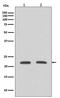 Ras Homolog Family Member A antibody, M00207, Boster Biological Technology, Western Blot image 