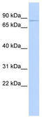 Potassium Voltage-Gated Channel Subfamily D Member 2 antibody, TA338567, Origene, Western Blot image 