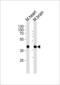 SH3 Domain Binding Kinase 1 antibody, PA5-49384, Invitrogen Antibodies, Western Blot image 