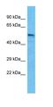 Gamma-Aminobutyric Acid Type A Receptor Beta3 Subunit antibody, orb329580, Biorbyt, Western Blot image 