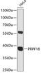 Pre-MRNA Processing Factor 18 antibody, 14-643, ProSci, Western Blot image 