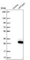 Transmembrane O-methyltransferase antibody, NBP1-92081, Novus Biologicals, Western Blot image 