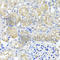 Histidyl-TRNA Synthetase 2, Mitochondrial antibody, A7785, ABclonal Technology, Immunohistochemistry paraffin image 