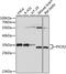 Pyrroline-5-Carboxylate Reductase 2 antibody, A10327, Boster Biological Technology, Western Blot image 