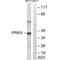Protein Kinase X-Linked antibody, A06585, Boster Biological Technology, Western Blot image 