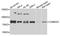 Calcium/Calmodulin Dependent Protein Kinase II Gamma antibody, A3231, ABclonal Technology, Western Blot image 