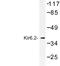 Potassium Voltage-Gated Channel Subfamily J Member 11 antibody, LS-C177113, Lifespan Biosciences, Western Blot image 