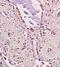 Low Density Lipoprotein Receptor antibody, orb10972, Biorbyt, Immunohistochemistry paraffin image 