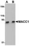 MET Transcriptional Regulator MACC1 antibody, MBS151243, MyBioSource, Western Blot image 