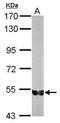 Karyopherin Subunit Alpha 1 antibody, GTX112284, GeneTex, Western Blot image 