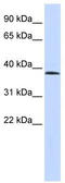 Lysine Methyltransferase 5B antibody, TA338057, Origene, Western Blot image 