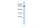 ADAM Metallopeptidase Domain 9 antibody, GTX46454, GeneTex, Western Blot image 