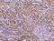 Ankyrin Repeat Domain 30B antibody, 204515-T08, Sino Biological, Immunohistochemistry paraffin image 