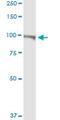 ATPase Plasma Membrane Ca2+ Transporting 4 antibody, H00000493-D01P, Novus Biologicals, Western Blot image 