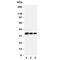 T-Box 21 antibody, R31106, NSJ Bioreagents, Western Blot image 