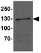 Formin Like 1 antibody, GTX31512, GeneTex, Western Blot image 