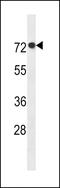 ArfGAP With GTPase Domain, Ankyrin Repeat And PH Domain 11 antibody, 60-635, ProSci, Western Blot image 