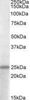 PACAP38 antibody, TA305626, Origene, Western Blot image 