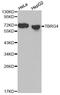 Transforming Growth Factor Beta Regulator 4 antibody, MBS125460, MyBioSource, Western Blot image 