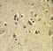 VPS53 Subunit Of GARP Complex antibody, LS-C160543, Lifespan Biosciences, Immunohistochemistry paraffin image 