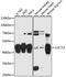 LUC7 Like 2, Pre-MRNA Splicing Factor antibody, LS-C748160, Lifespan Biosciences, Western Blot image 