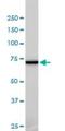 NIMA Related Kinase 11 antibody, H00079858-M01, Novus Biologicals, Western Blot image 