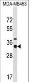 Myozenin 2 antibody, LS-C158349, Lifespan Biosciences, Western Blot image 