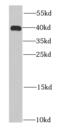 Heparin Binding Growth Factor antibody, FNab03809, FineTest, Western Blot image 