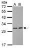 Hydroxysteroid 17-Beta Dehydrogenase 10 antibody, PA5-29740, Invitrogen Antibodies, Western Blot image 