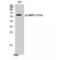 Dihydropyrimidinase Like 2 antibody, LS-C381538, Lifespan Biosciences, Western Blot image 