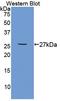 TNF Receptor Superfamily Member 1B antibody, LS-C692572, Lifespan Biosciences, Western Blot image 