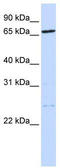 Tousled Like Kinase 1 antibody, TA344374, Origene, Western Blot image 