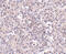 Zinc transporter ZIP10 antibody, 4991, ProSci, Immunohistochemistry paraffin image 