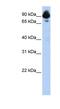 Regulator Of G Protein Signaling 3 antibody, NBP1-58312, Novus Biologicals, Western Blot image 