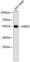 MIER Family Member 2 antibody, 19-468, ProSci, Western Blot image 