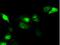 Serine racemase antibody, NBP2-02332, Novus Biologicals, Immunocytochemistry image 