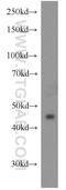 Lymphocyte Transmembrane Adaptor 1 antibody, 21557-1-AP, Proteintech Group, Western Blot image 