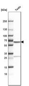 Transketolase Like 1 antibody, HPA000505, Atlas Antibodies, Western Blot image 