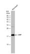 Natriuretic Peptide A antibody, NBP2-14873, Novus Biologicals, Western Blot image 