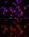 Alpha-1-antitrypsin antibody, GTX66005, GeneTex, Immunocytochemistry image 